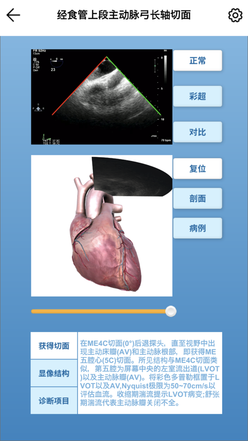 维思模TEE