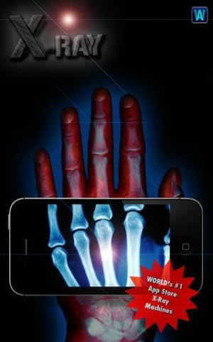手机扫描骨骼软件