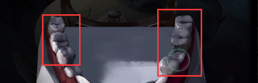 黑暗笔录金牙获得攻略 取下金牙的方法