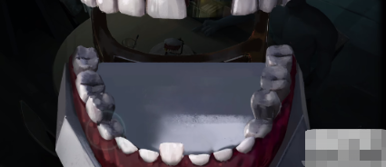 黑暗笔录金牙怎么换蛋 金牙换蛋攻略分享